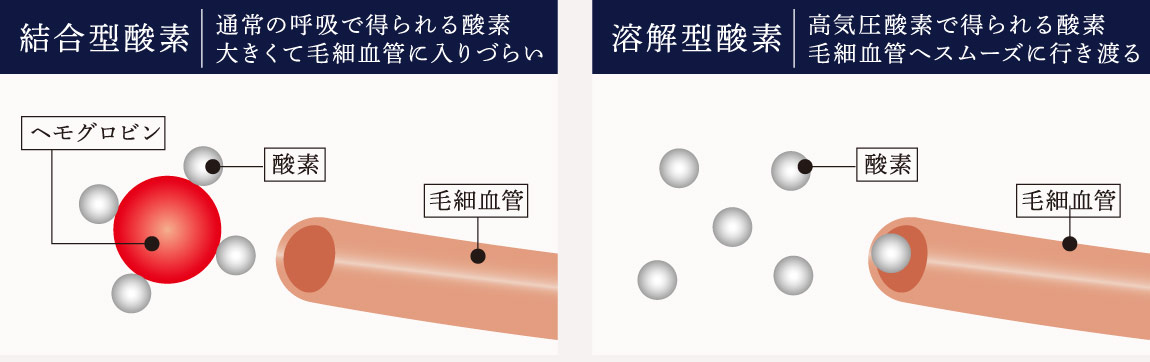 結合型酸素：通常の呼吸で得られる酸素、大きくて毛細血管に入りづらい　溶解型酸素：高気圧酸素で得られる酸素、毛細血管へスムーズに行き渡る